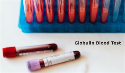 beta 1 globulin low|Globulin Blood Test: Uses, Procedure, Results .